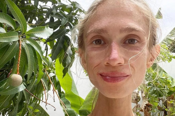 Умерла девушка, питавшаяся только фруктами — она весила чуть больше 20 кг Умерла девушка, питавшаяся только фруктами — она весила чуть больше 20 кг